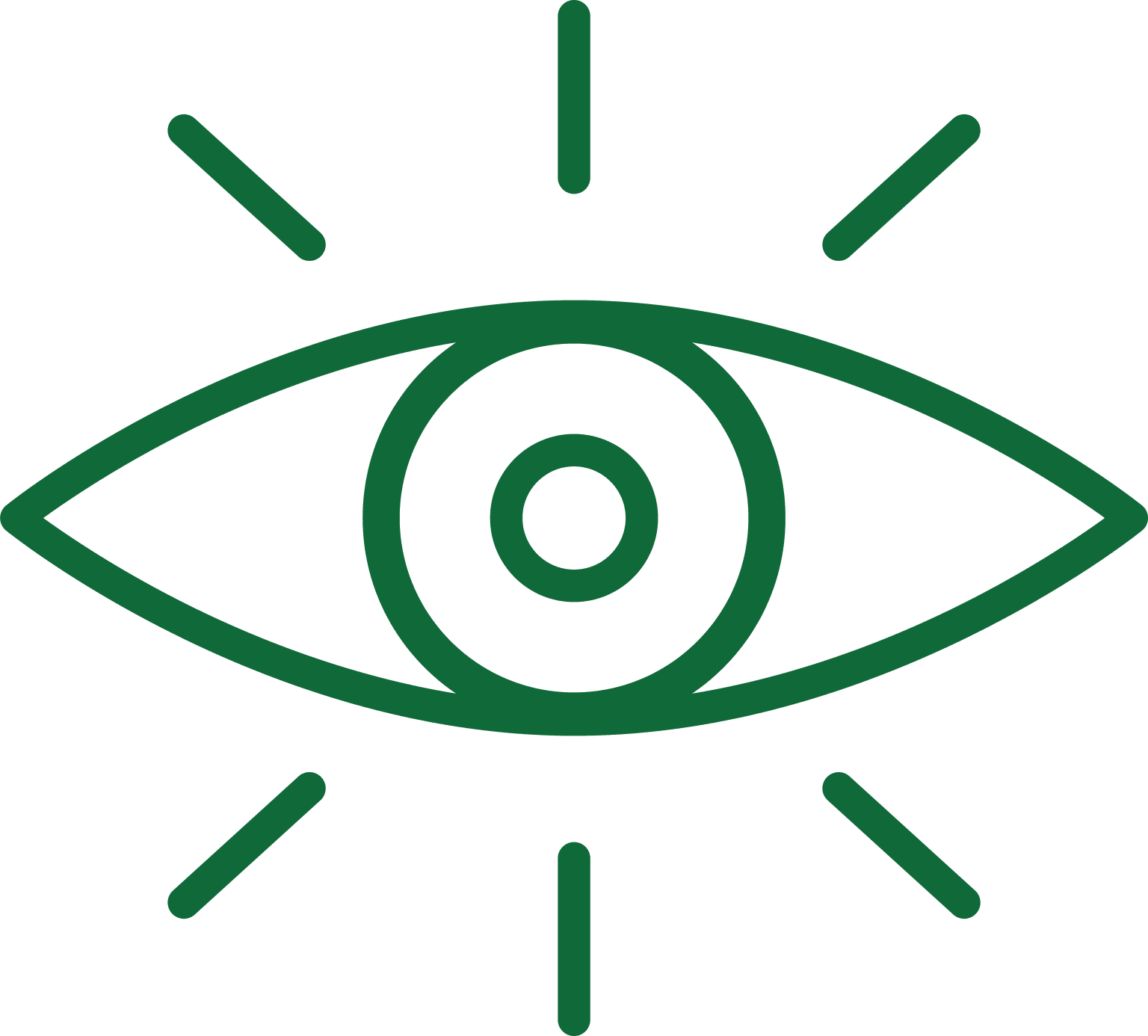 Vision